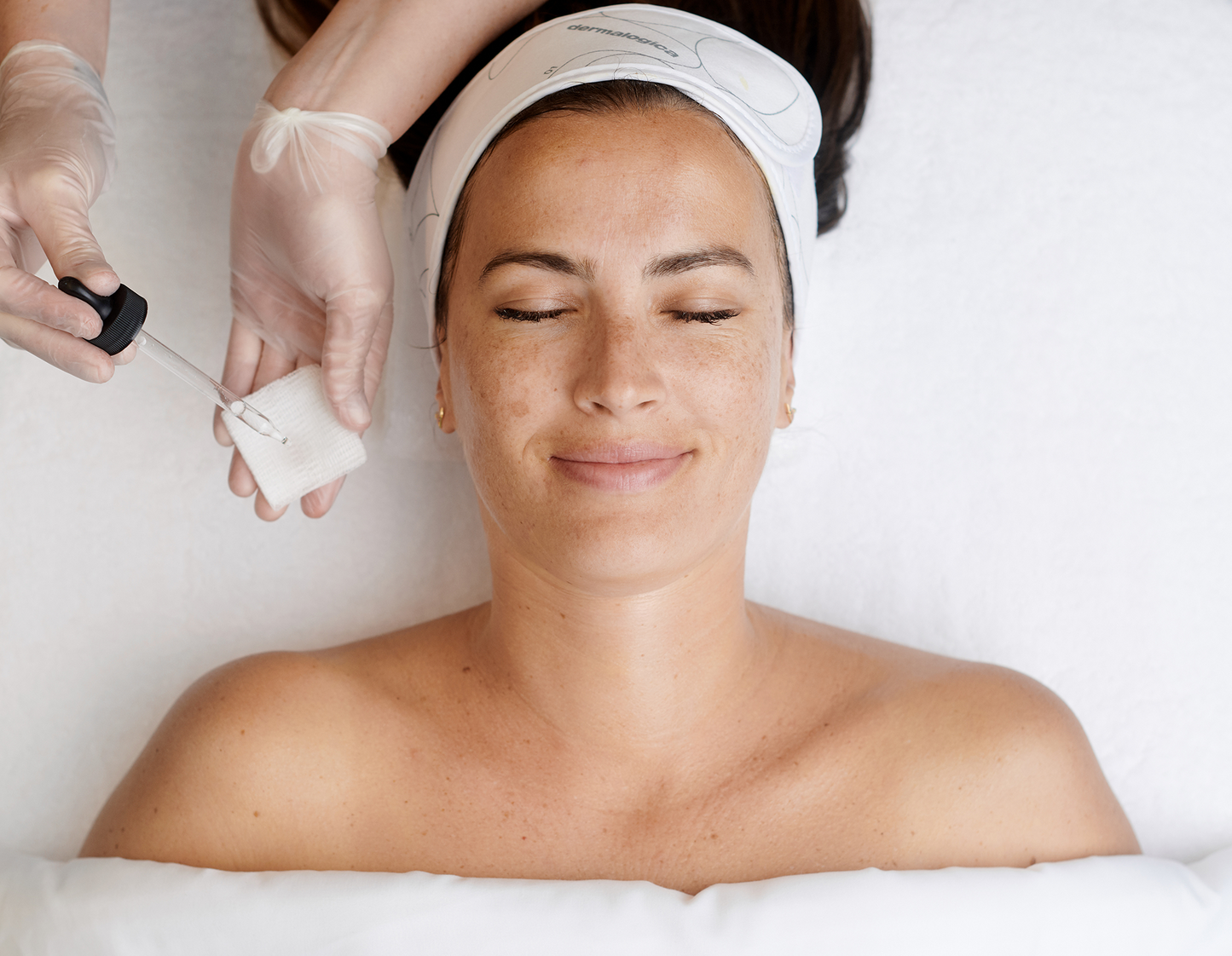 Chemical Peel