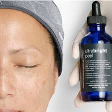 Ultra Bright Peel