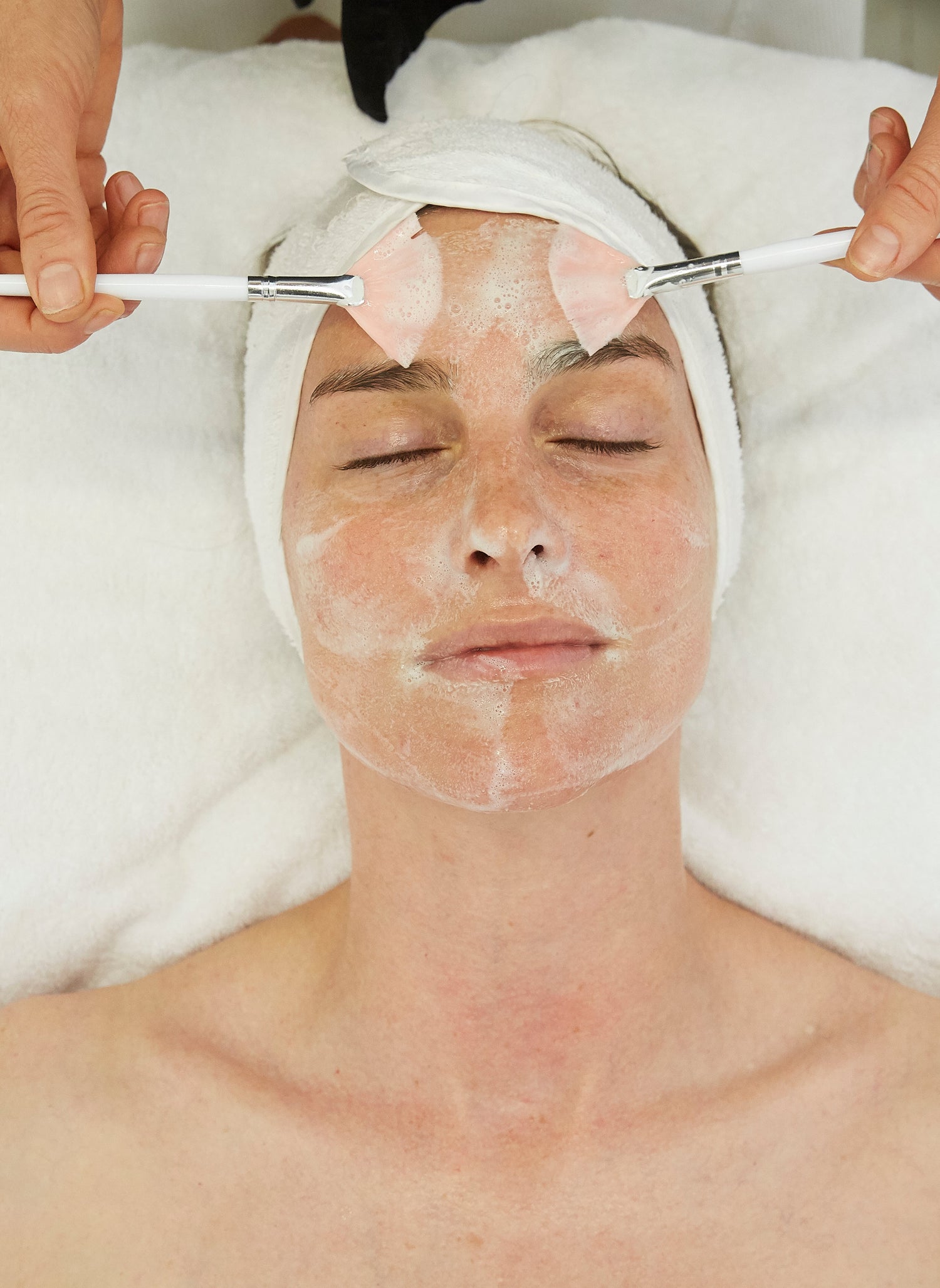 Image Peels