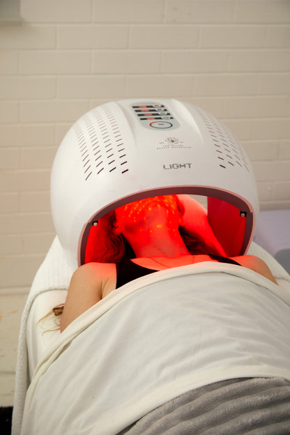 MicroNeedling