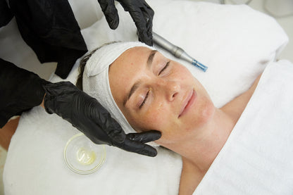 Microneedling