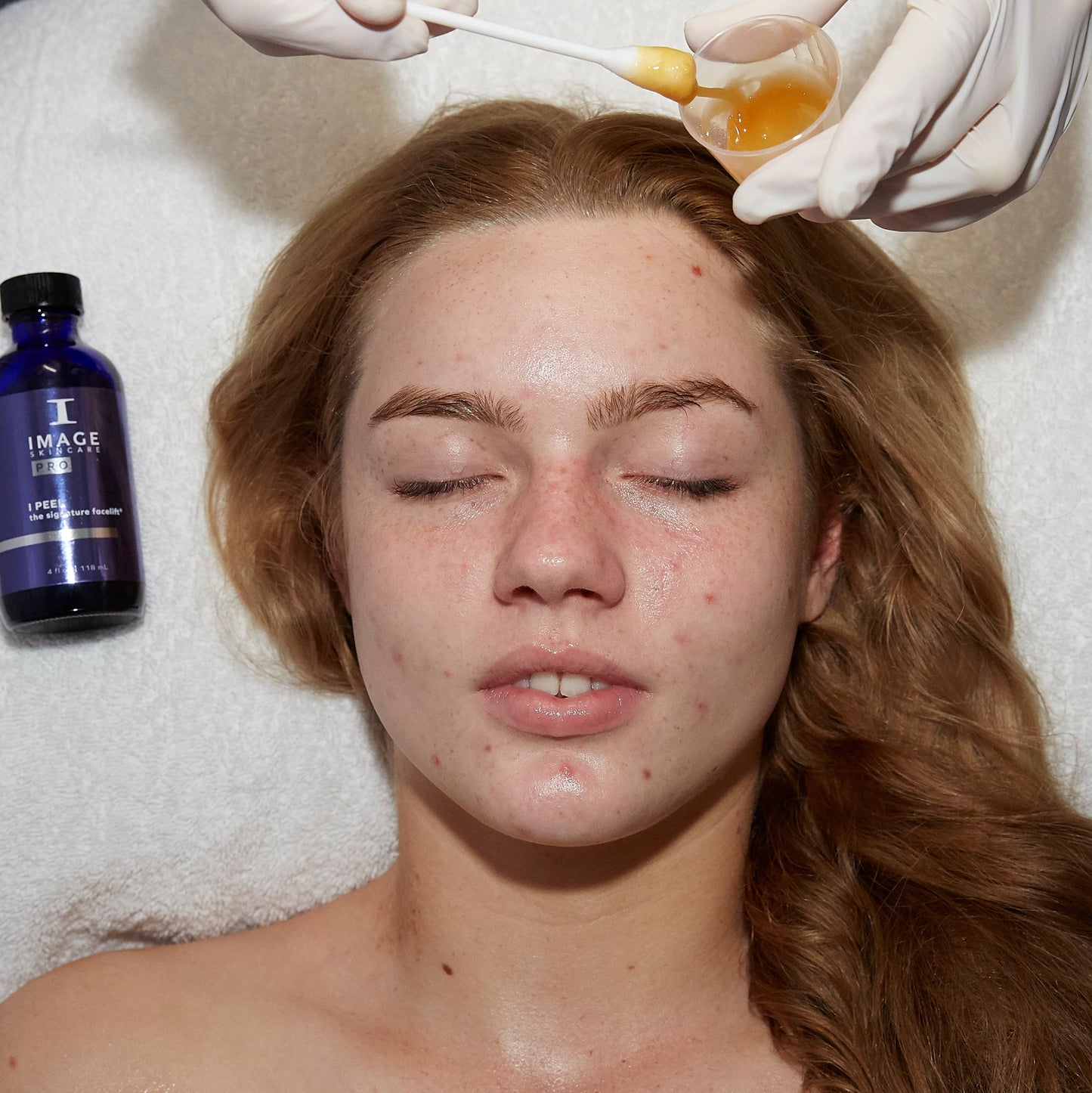 Image Lightening Lift® Peel