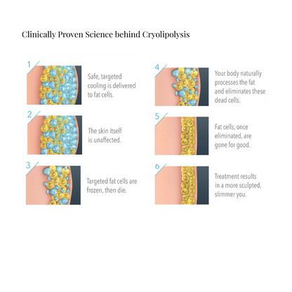 Cryolipolysis - Fat Freezing