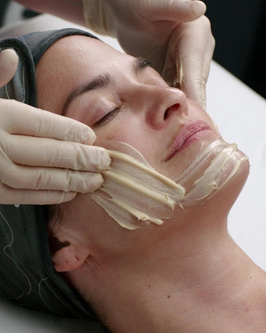 Melanopro Peel Treatment